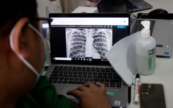 Tuntaskan TBC, Pemerintah Siapkan Perlindungan Sosial bagi Pekerja Informal