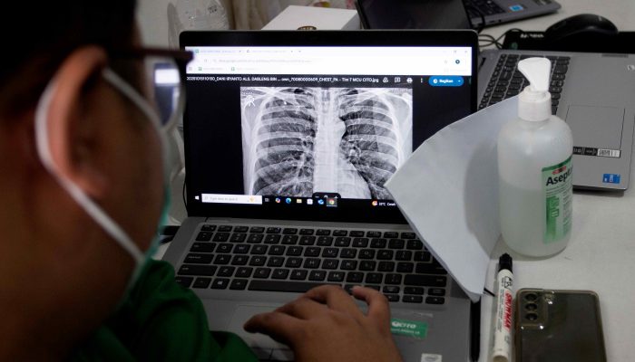 Tuntaskan TBC, Pemerintah Siapkan Perlindungan Sosial bagi Pekerja Informal